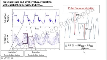 Fluid Responsiveness   do you have to fill to the gills