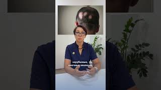 Почему выпадают волосы?