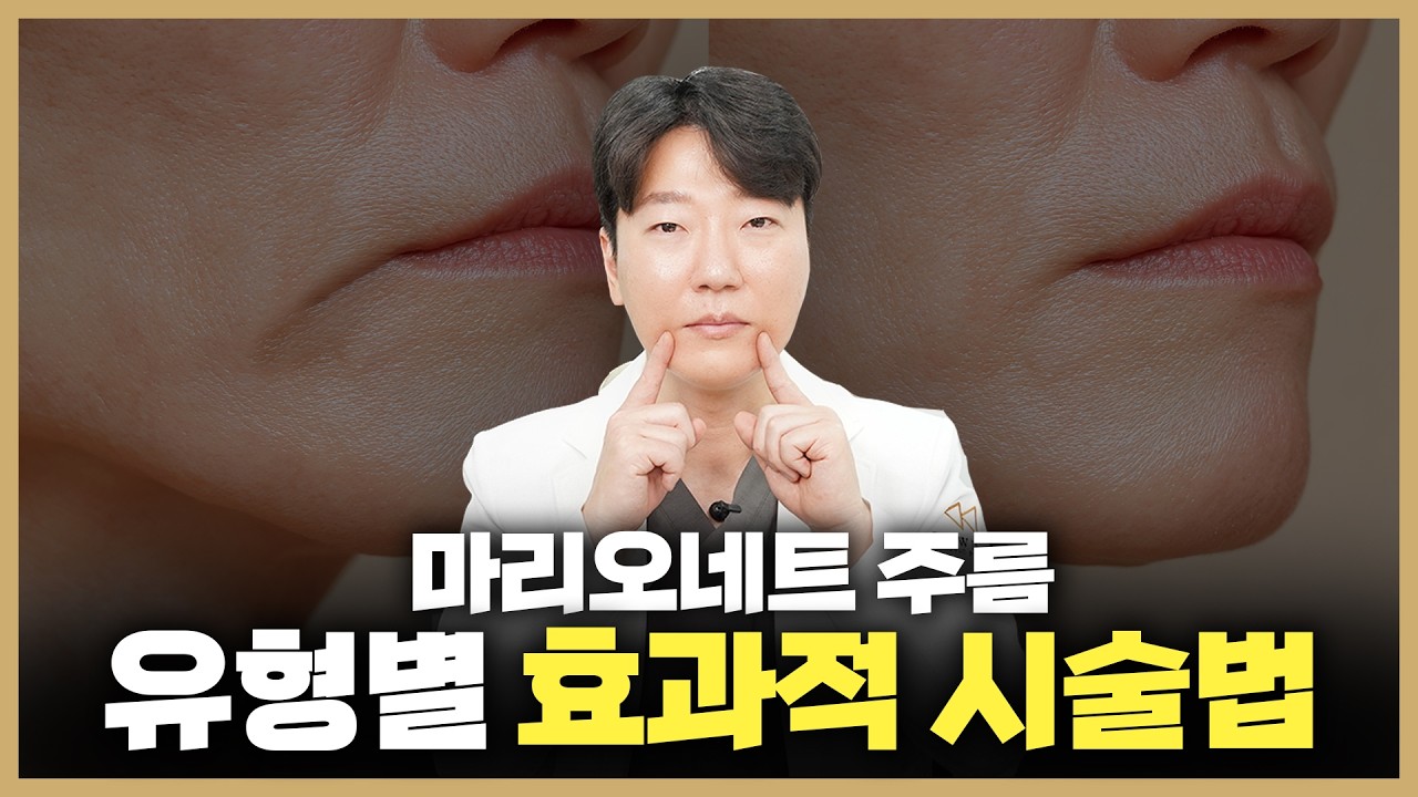 마리오네트 주름은 어떻게 효과적으로 해결할 수 있을까요❔│유형별 마리오네트 주름 해결법