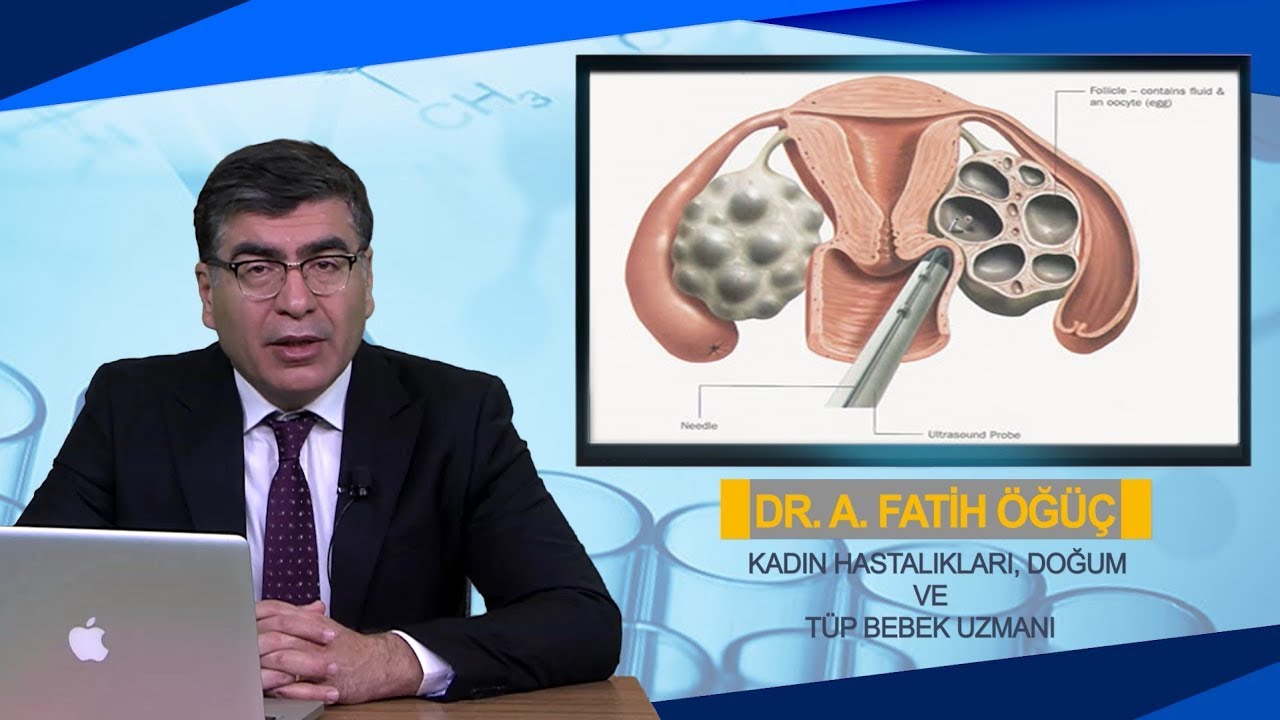 Tüp Bebek Tedavisinde Yumurta Toplama Aşamasında Tüp Bebek Tedavisinde Yumurta Toplama Aşamasında