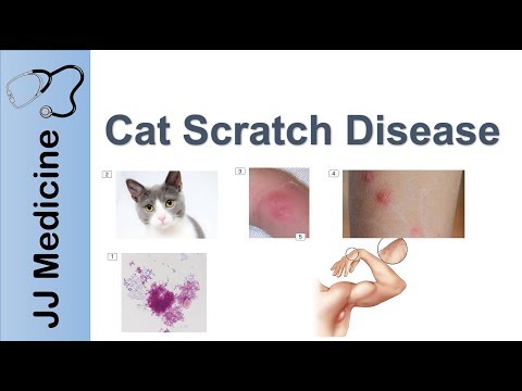 Cat Scratch Disease | Causes, Symptoms and Treatment