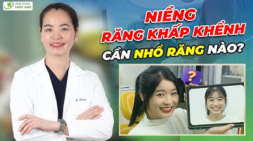 Niềng Răng Khấp Khểnh Có Cần Thiết Phải Nhổ Răng? Phân tích từng trường hợp cụ thể