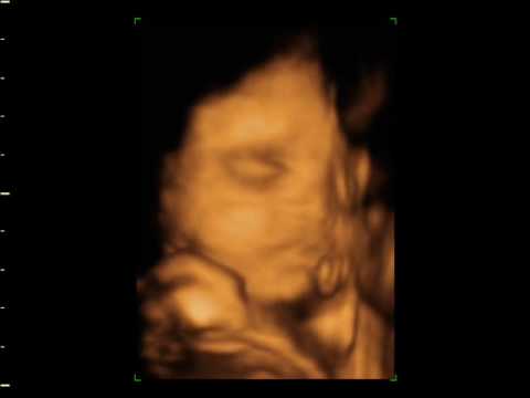 ultrasound near me Baby of Nina and Andrew