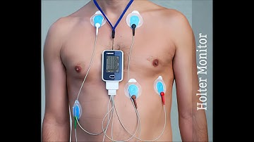 Electrocardiographic recording CPT code - simplify medical coding