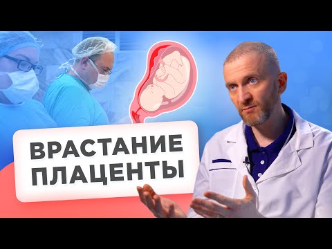 Беременность и роды с врастанием плаценты. Что нужно знать?