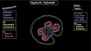 Diyabetik Nefropati Klinik Bulgu Ve Tedavi Sağlık Bilgisi Ve Tıp