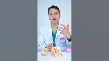 Dán Sứ Hay Bọc Sứ – Lựa Chọn Nào Tốt Hơn Cho Nụ Cười Của Bạn? | Dr Cường Official