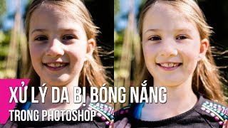 Xử Lý Da Bị Bóng Nắng Trong Photoshop | Thùy Uyên screenshot 3
