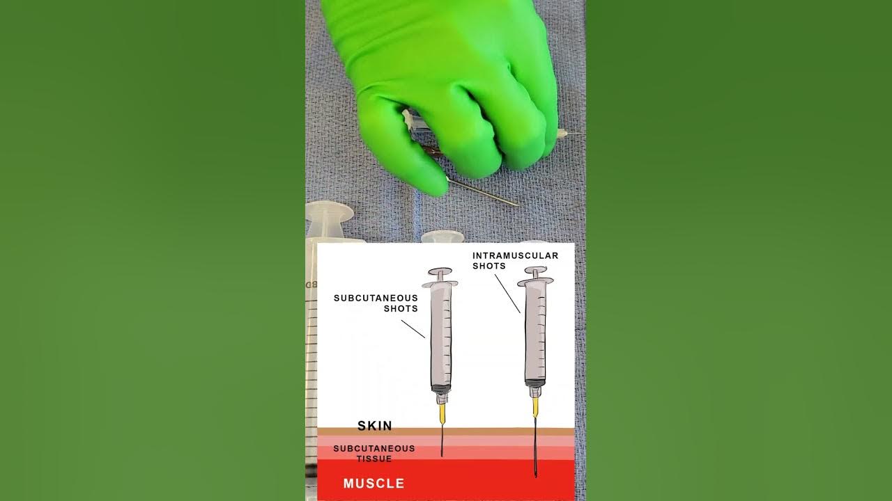Hypodermic Needle and Syringe Choice Basics YouTube