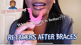 BRACES UPDATE | HAWLEY RETAINER VS CLEAR RETAINER ????