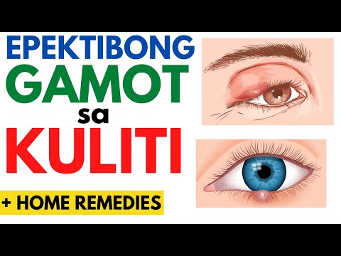 👀 GAMOT sa KULITI | Paano gumaling ang KULITI o BUTLIG sa MATA? + Home Remedies, Sintomas | Eye Sty