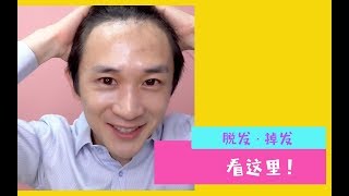 掉发、脱发、发际线太高？怎么办？看过来看过来！