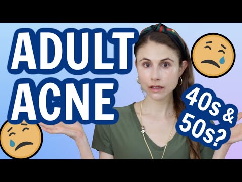 Adult acne in your 40s and 50s| Dr Dray