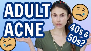 Adult acne in your 40s and 50s| Dr Dray