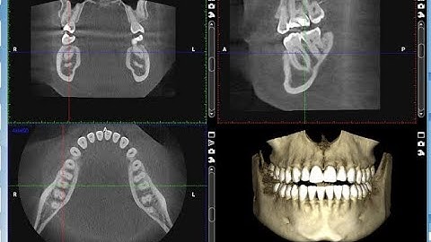 Basics of reading #CBCT image using #Romexis software. By Dr.Sally Mansour