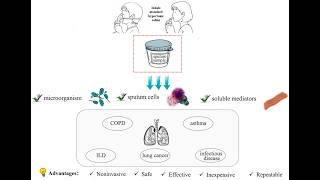 Using Sputum to Investigate or Diagnose Respiratory system Diseases
