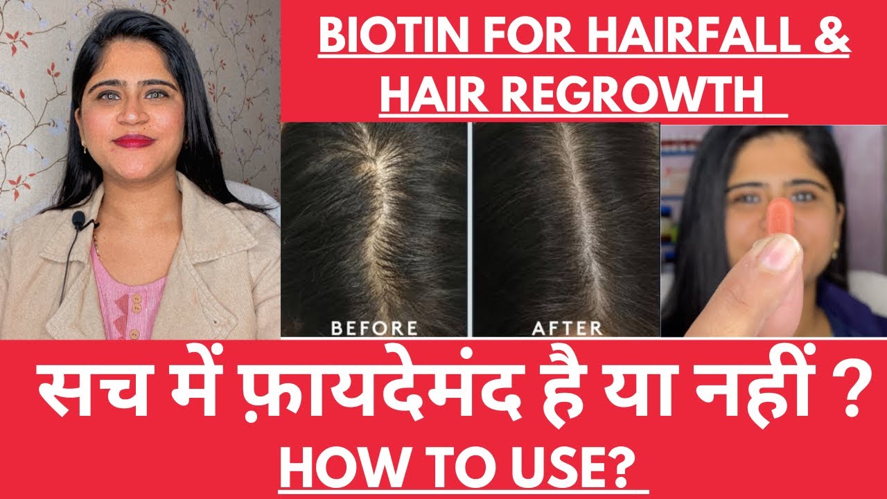BIOTIN For Hair Regrowth॥सच में फ़ायदेमंद है या नहीं ? What is Biotin