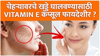 चेहऱ्यावरील खड्डे घालवण्यासाठी काय करावं | How to Get Rid of Acne Scars | Acne Scars Treatment