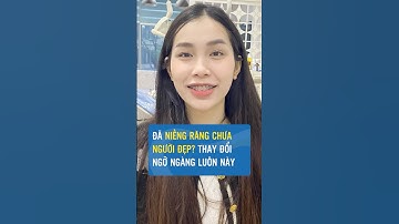 Đã niềng răng chưa người đẹp #niengrang #nieng
