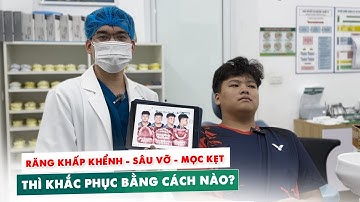 Niềng Răng Bắt Đầu Hành Trình Chứa Răng Khấp Khểnh, Sâu Vỡ, Mọc Kẹt.