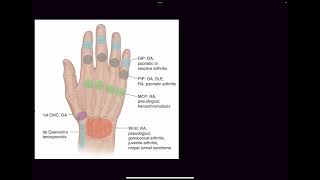 Basics of Rheumatoid arthritis with Q&A for USMLE AMC NEET - I