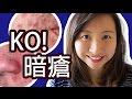 我的暗瘡粉刺治癒之路 【How I Get Rid Of Acne】｜陳怡 ChanYee