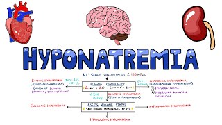 An Approach to Hyponatremia -  Hyponatremia Diagnostic Algorithm | Hyponatremia Causes MADE EASY