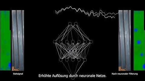 QASS BURN DETECTION (Short Video)