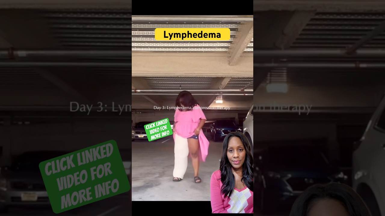 LYMPHEDEMA SYMPTOMS! 😱 #shortsfeed #shortsvideo #shorts