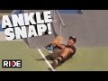 Ankle snap skateboarding slam  alex curtis