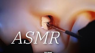 ASMR 내가 딱딱한 귀지다!!!!!!!! 귀를 꽉 막은 딱딱한 귀지 제거 귀청소 (No talking)