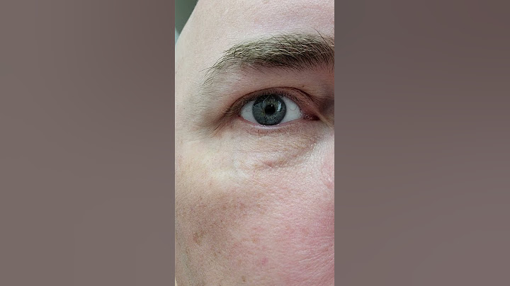 Eye bubbles,  listen to them!