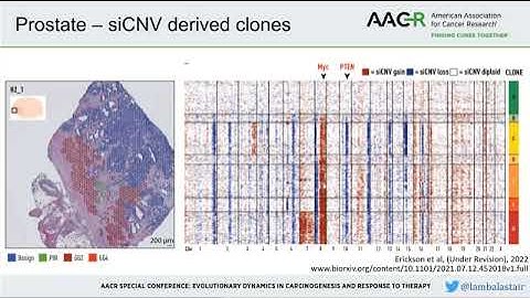 The Spatial Landscape of Clonal Somatic Mutations in Benign & Malignant Tissue - AACR Evol 2022 Talk