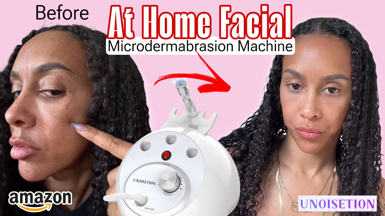 "Unoisetion AMAZON Microdermabrasion Facial Machine Review | At-Home Skin Rejuvenation Tool"