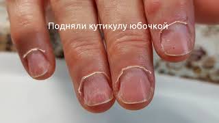 Поднятие кутикулы Поднятие кутикулы