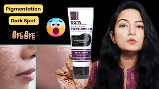 Best kojic acid cream for skin whitening, dark spots & hyper pigmentation || Honest Review
