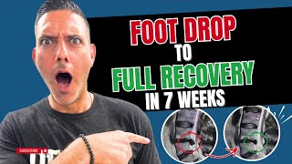 Foot Drop Is a Neurological Red Flag | Avoid Surgery & Explore Another Option in California