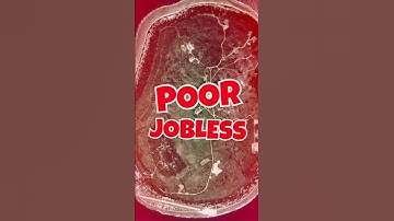 Why is Nauru the Most Obese Country?