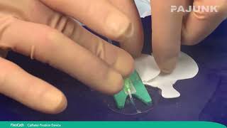 FixoCath with E-Cath - How to connect a catheter