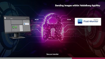 Workflow with RetInSight | Heidelberg Engineering AppWay