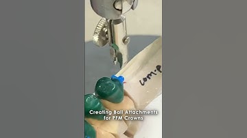 Creating Ball Attachments for PFM Crowns #dental #smile #teeth #shorts #shortvideo #metal #casting
