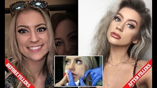 Ashly Schwan Reveals Ordeal With Botched Lip Fillers - Hot Girl