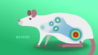 Early detection of melanoma metastasis and new targets for treatment