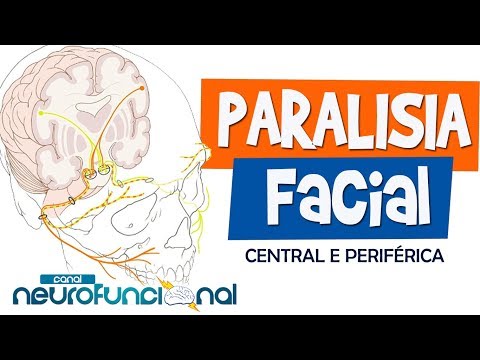Vídeo: Nervo Facial - Causas, Sintomas E Tratamento De Paresia, Paralisia, Neuropatia E Nervo Facial Comprimido