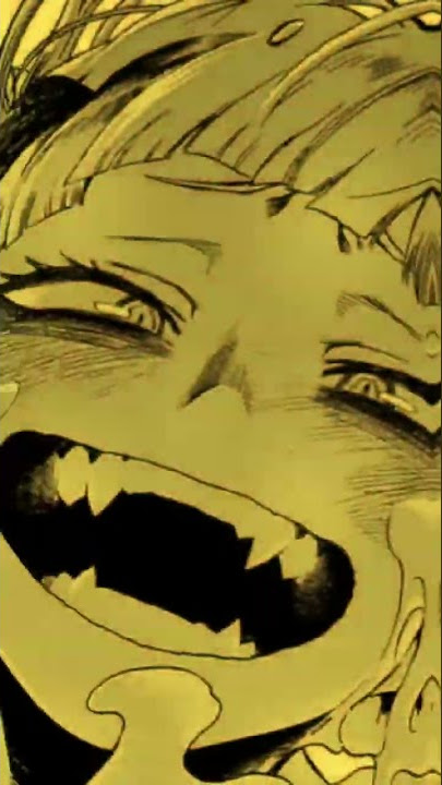 Toga edit  18 👀💉/ Leer descripción