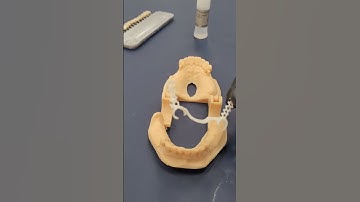 digital workflow in action #dental #dentallab