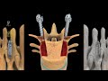 QUATTRO : Spinal Pedicle Screw Design Comparison