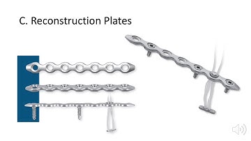 Ankle Fracture Management System Tray Overview