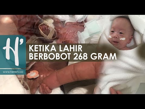 Video: Bayi Yang Terkecil Yang Bertahan Di Dunia Akhirnya Pulang Dari Hospital San Diego: 'Dia Keajaiban