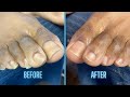 Pedicure on a Dude - Dry Pedicure Technique